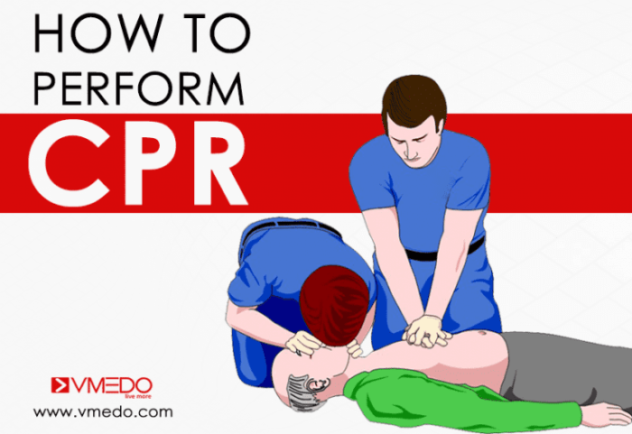 How to Perform CPR