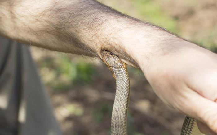 Bite venomous snakebite Bite venomous snakebite