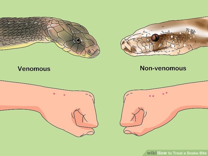 Snake bite treat prevent venomous Snake bite treat prevent venomous