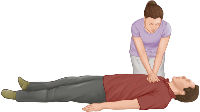 How to Perform CPR