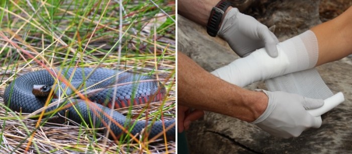 How to Treat a Snake Bite